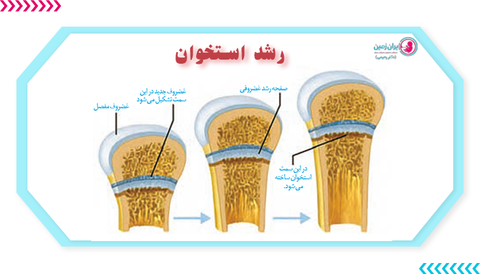 سن استخوانی در سنین مختلف