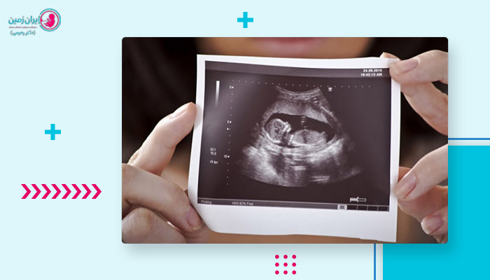 سونوگرافی هفته دوازدهم بارداری چه چیزی را نشان می دهد؟