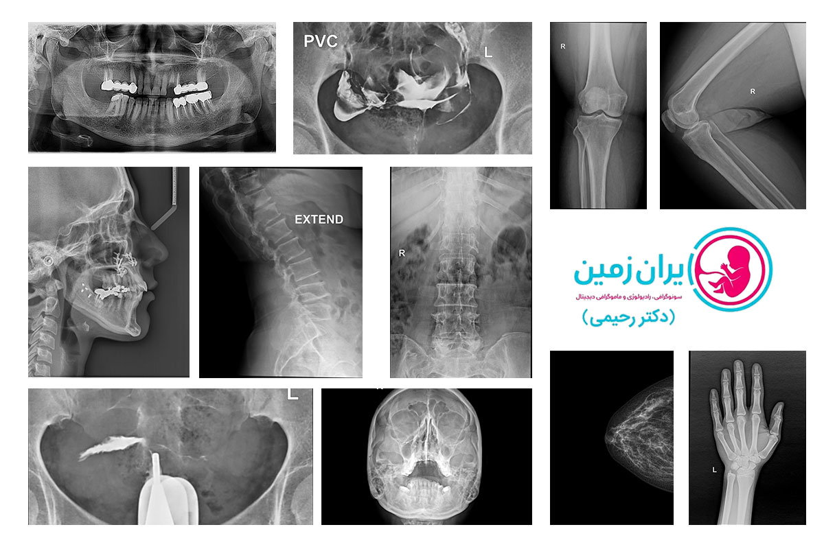 رادیوگرافی های مختلف